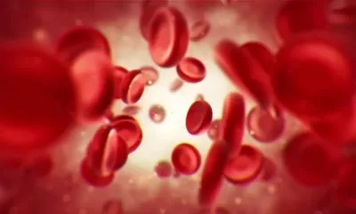 Beta thalassemia